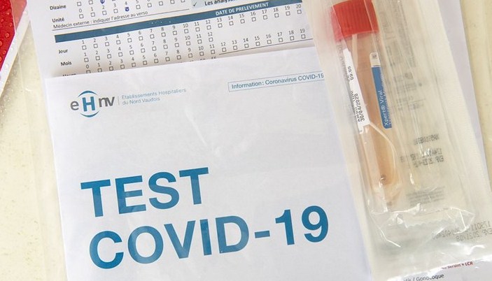 Američka agencija za lijekove odobrila prvi kućni test za covid-19