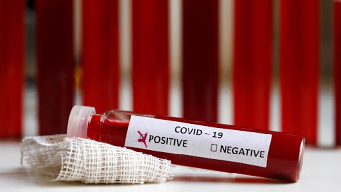 U Crnoj Gori još 22 slučaja koronavirusa