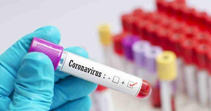 U Hrvatskoj 69 novooboljelih od koronavirusa