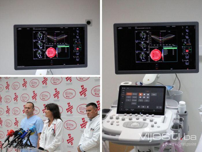 UKC RS nabavio aparat za srce koji koristi umjetnu inteligenciju