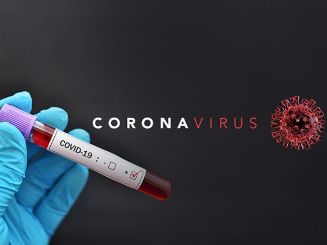 Virus u RS potvrđen kod 226 osoba